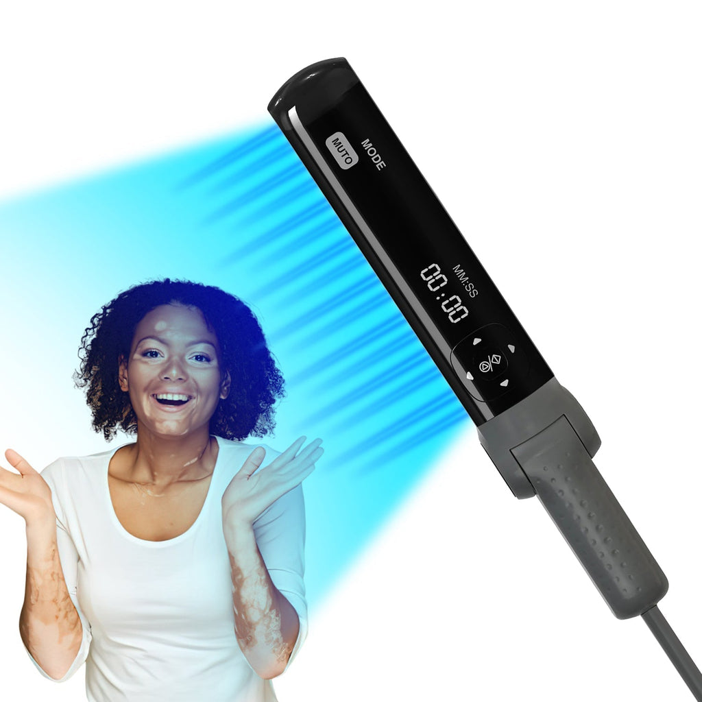 311nm UVB Light Therapy for Psoriasis and Vitiligo