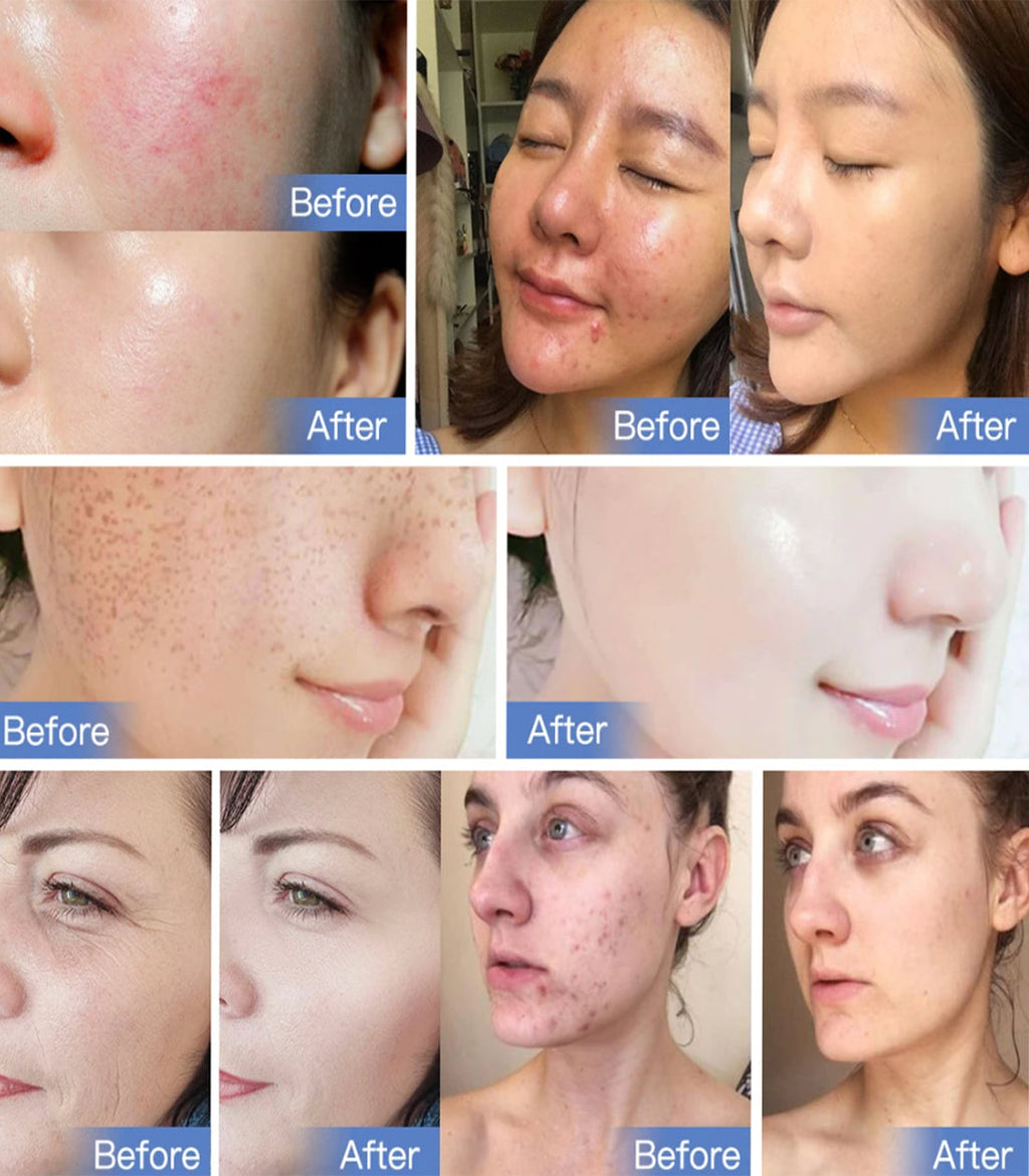 PDT LED Light Therapy Device With Seven Colors For Skin Rejuvenation