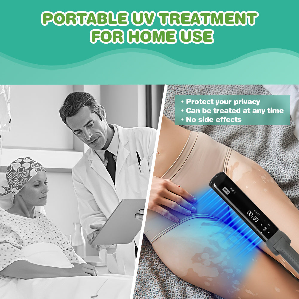 Home Use 311nm UVB Light Therapy for Psoriasis and Vitiligo
