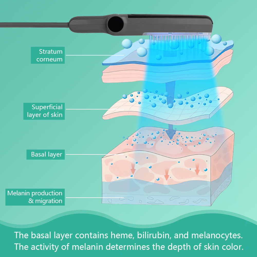 311nm UVB Light Therapy for Psoriasis and Vitiligo