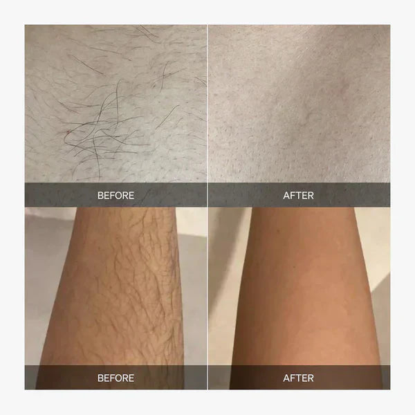 GlowPulse Full Body Smoothness With Zero Irritation