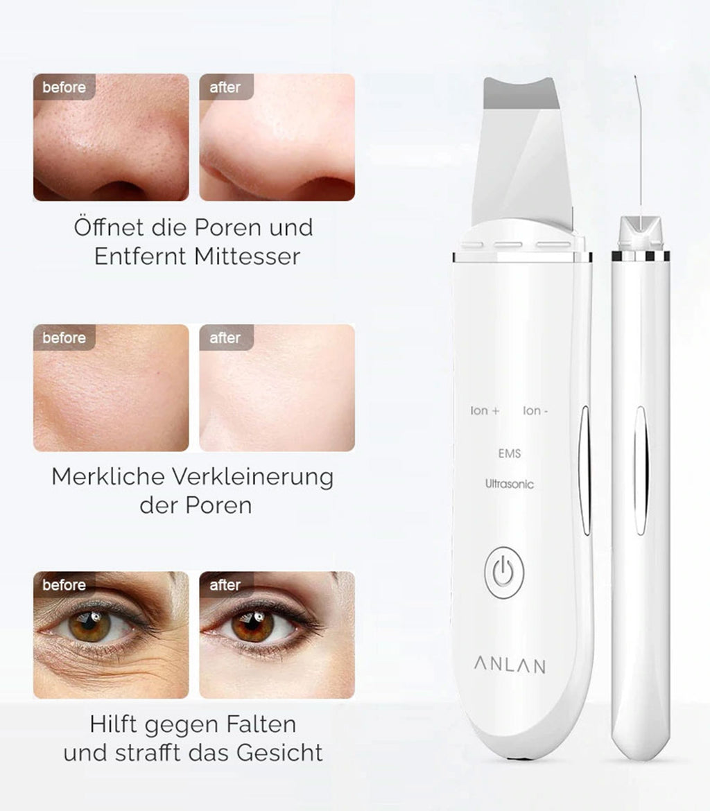 Limpiador Ultrasónico de Iones para Limpieza Facial en Casa
