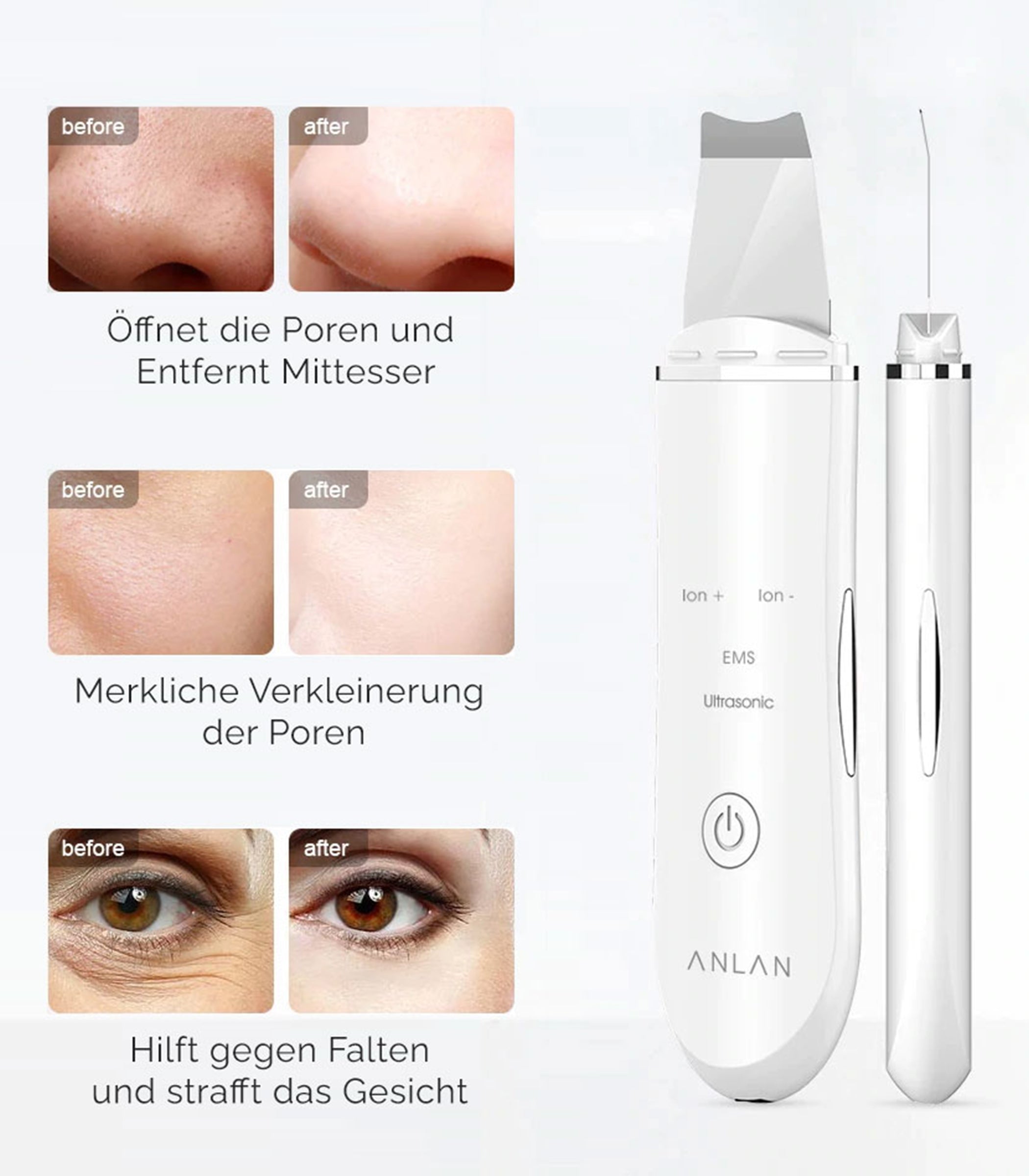 Limpiador Ultrasónico de Iones para Limpieza Facial en Casa