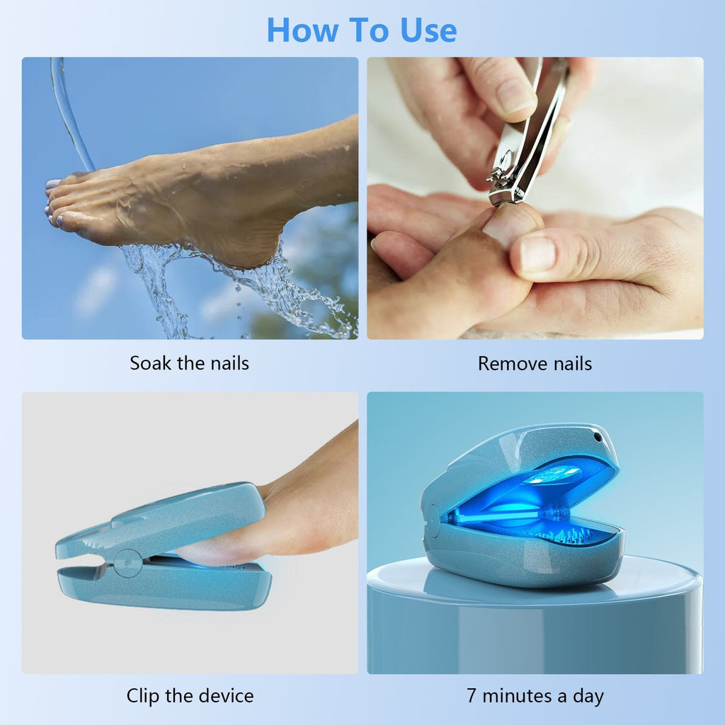 Portable Laser Therapy Nail Cleaning Device FDA Cleared