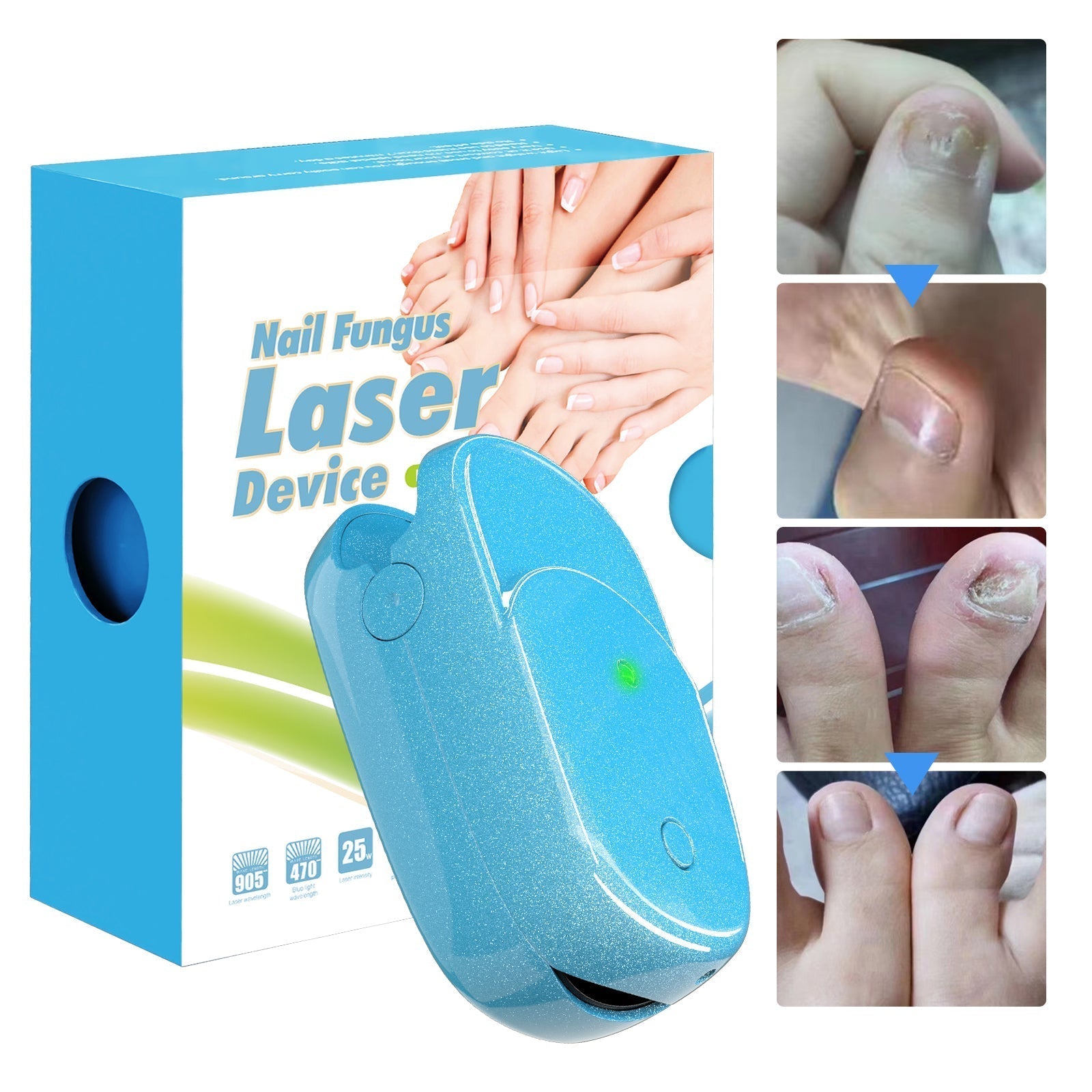 Portable Laser Therapy Nail Cleaning Device FDA Cleared