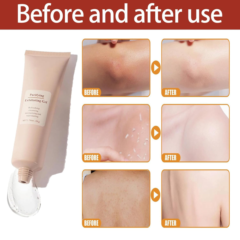 LumaGlow exfoliační gel pro zářivou pleť za jednu minutu