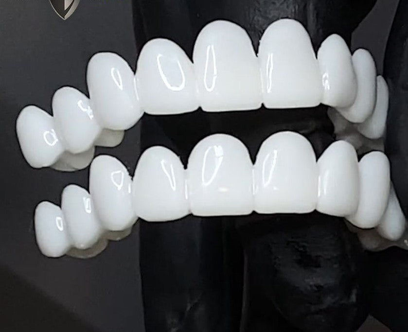 BrightGuard Veneers for Instant Smile Coverage of Imperfections