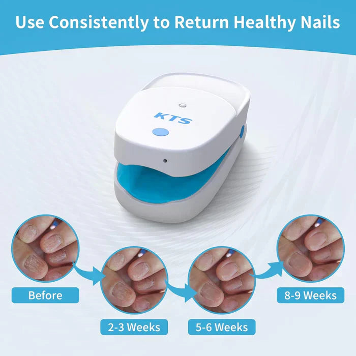 Sistema di Terapia Laser LuminNail per Funghi delle Unghie - Collezione Unghie
