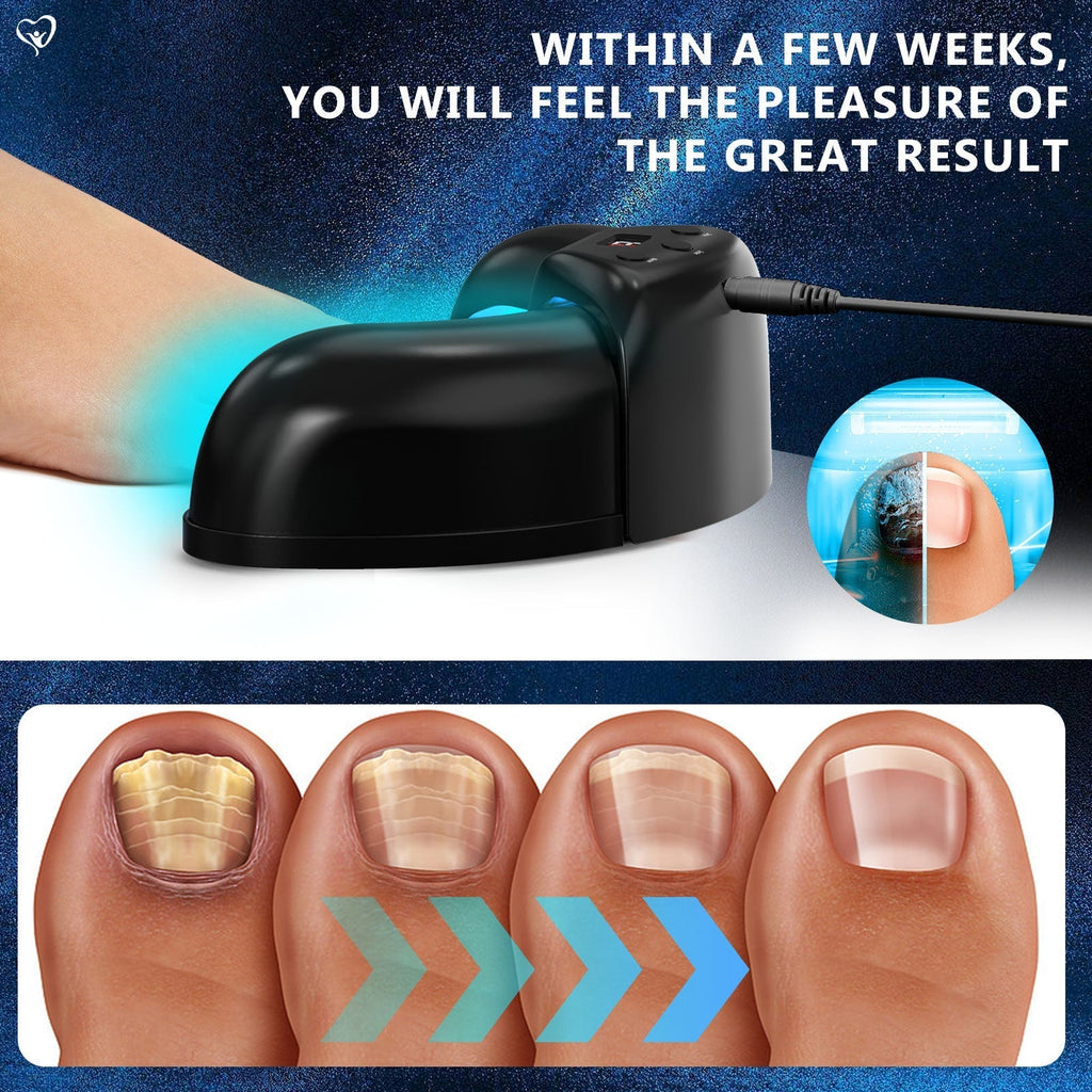 Toenail Fungus Light Therapy for Multiple Toenails