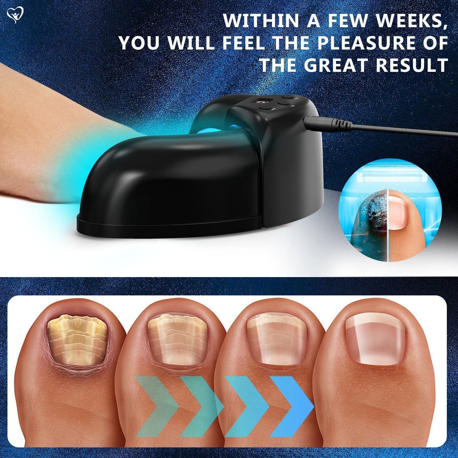 Toenail Fungus Light Therapy for Multiple Toenails