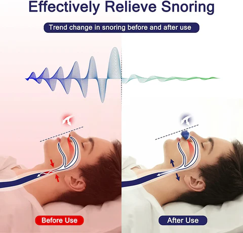 دستگاه CPAP مسافرتی جمع‌وجور برای درمان آپنه خواب و کاهش خرناس