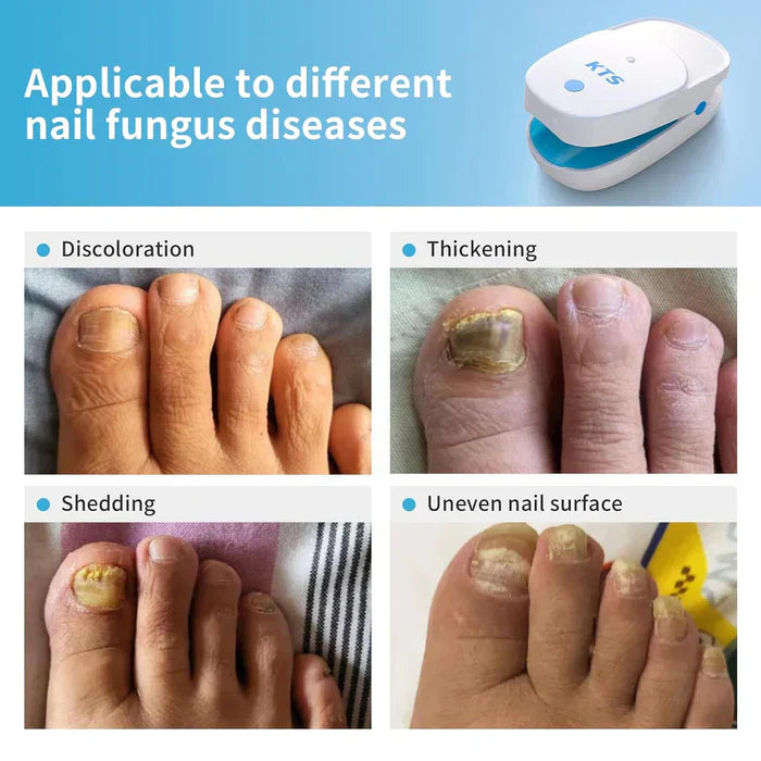 NovaPulse Nail Fungus Laser Treatment Devices Starter Kit