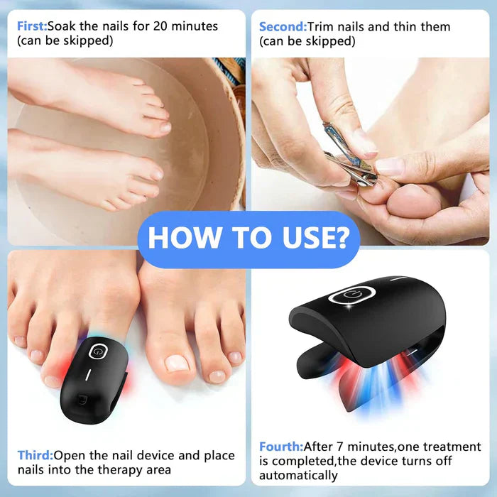 Nail Fungus Laser Therapy Device For Toenail Treatment