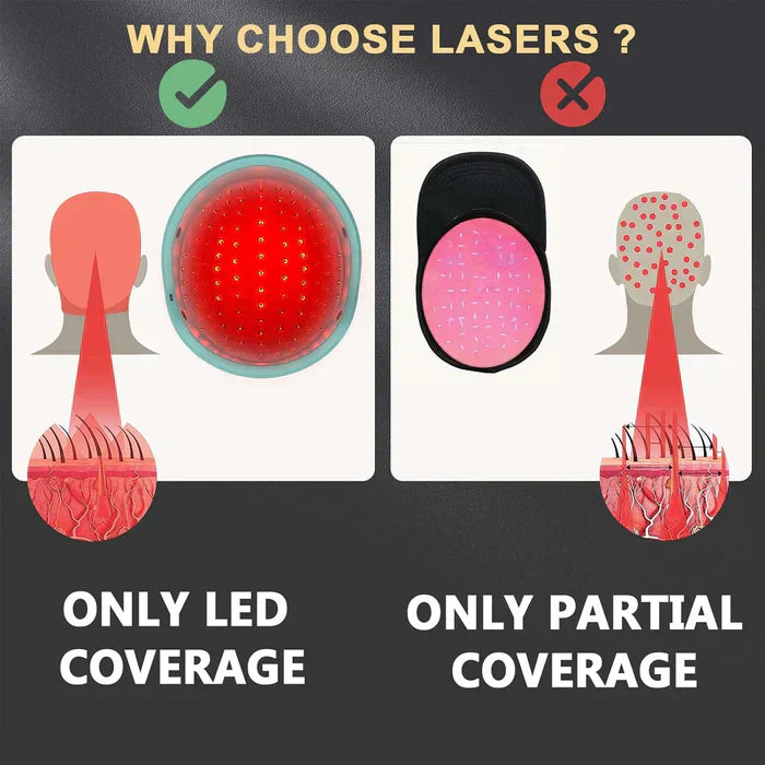 Trattamenti per la Ricrescita dei Capelli con Sistema a Cappello Laser