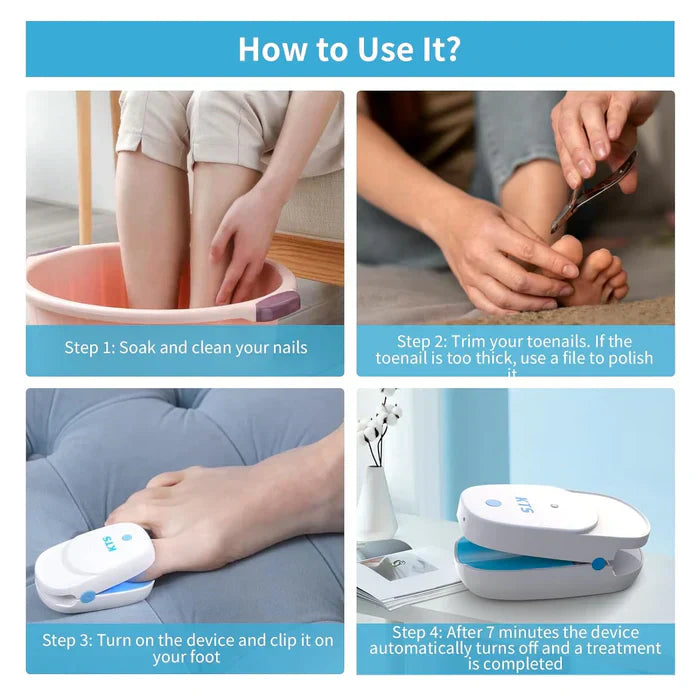 Sistema di Terapia Laser LuminNail per Funghi delle Unghie - Collezione Unghie