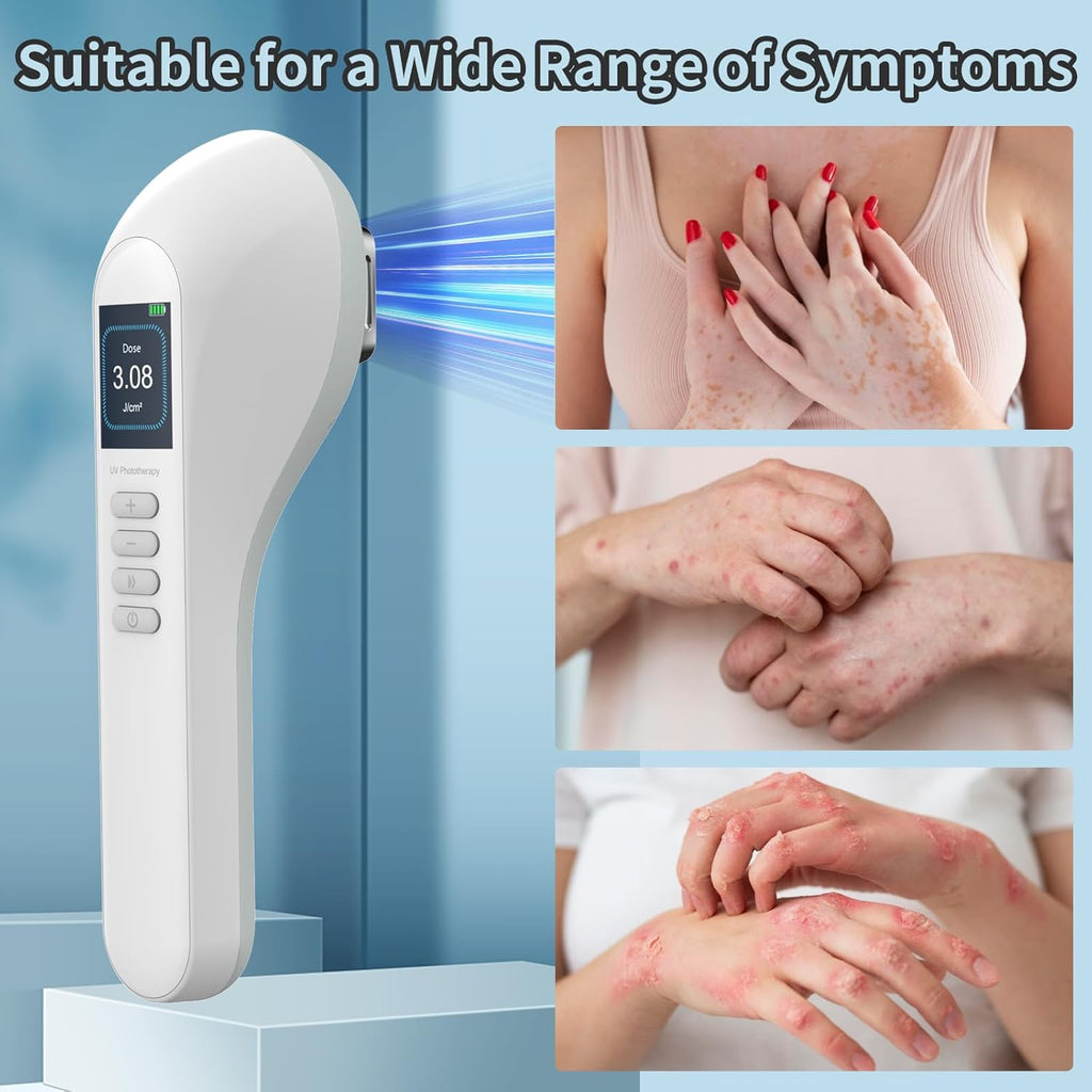 308nm UV Light Phototherapy LED Lamp for Home Use Model