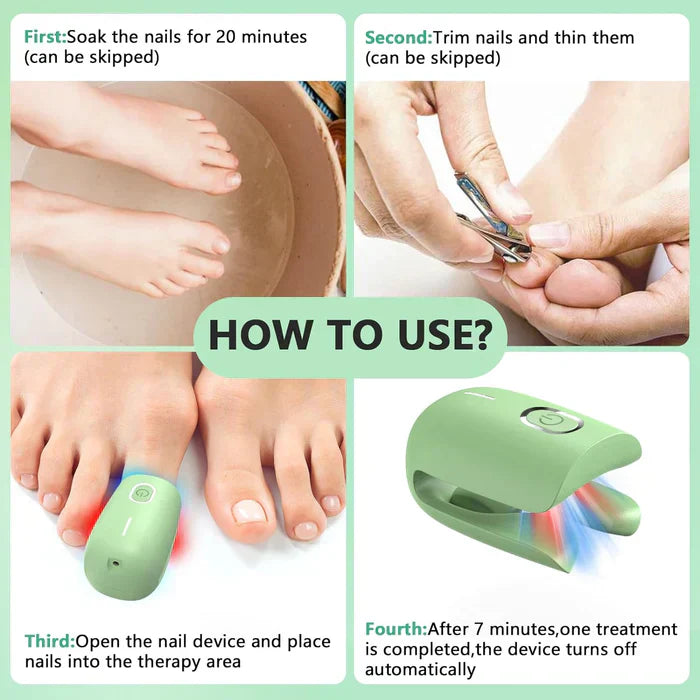 Nail Fungus Laser Therapy Device For Toenail Treatment