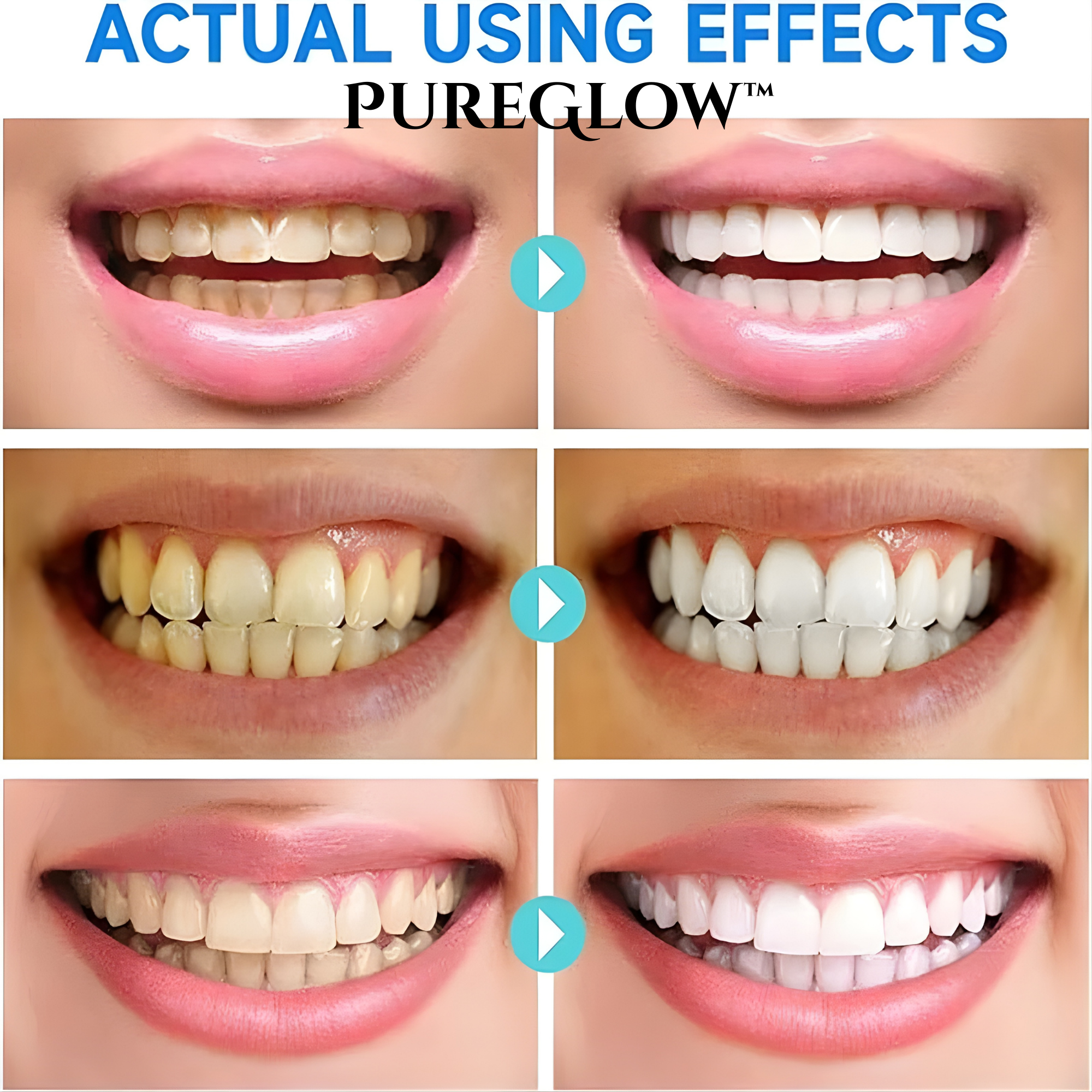 LumaBright Instant Niacinamide Brightening Toothpaste