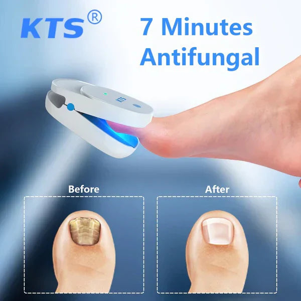 Sistema di Terapia Laser LuminNail per Funghi delle Unghie - Collezione Unghie