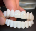 Dental Prosthesis For Confident Smiles And Everyday Comfort