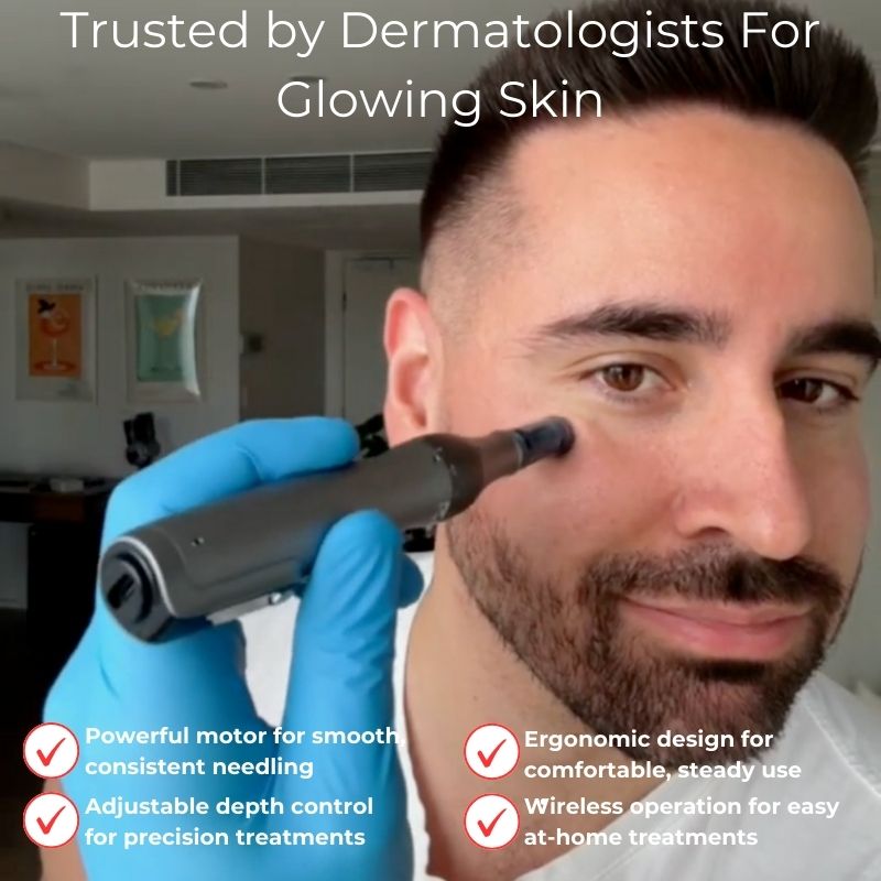 NovaDerm M8S Penna per Microneedling per il Ringiovanimento della Pelle