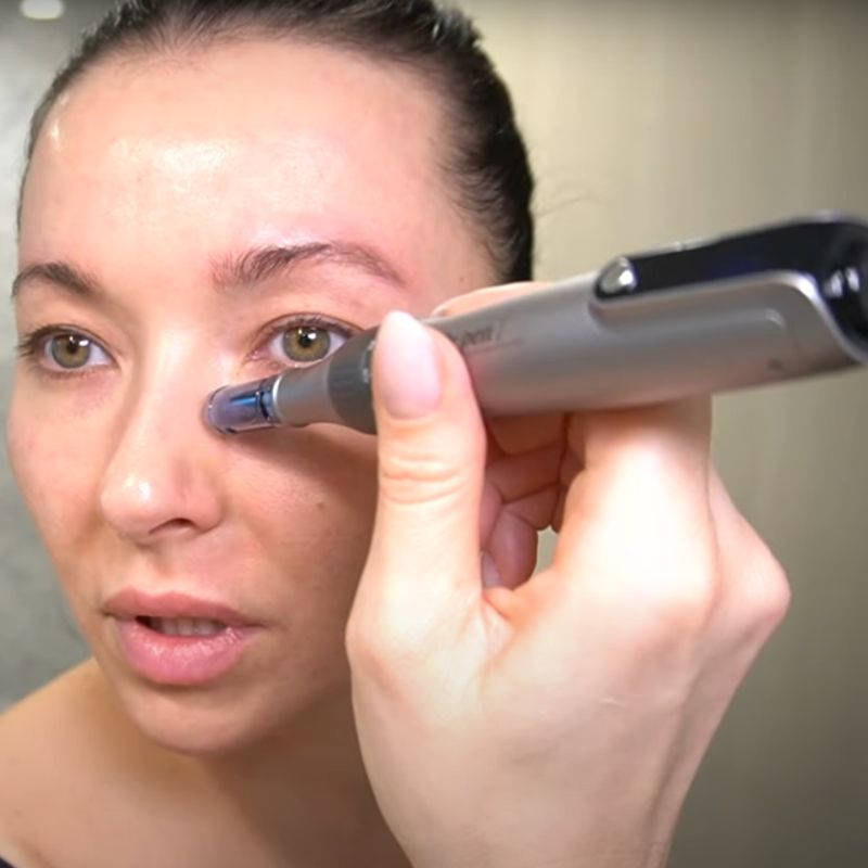 NovaDerm M8S Penna per Microneedling per il Ringiovanimento della Pelle