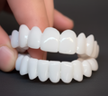 BrightGuard Veneers for Instant Smile Coverage of Imperfections
