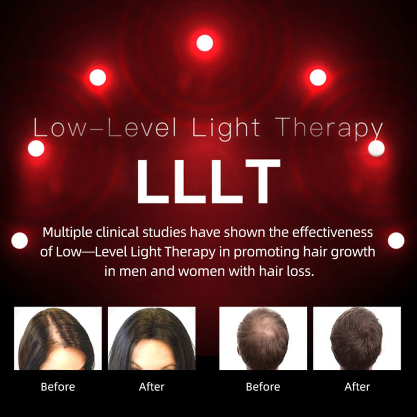 کلاهک رشد مو نوافولیکول LED - لیزر کم‌توان تایید شده توسط FDA