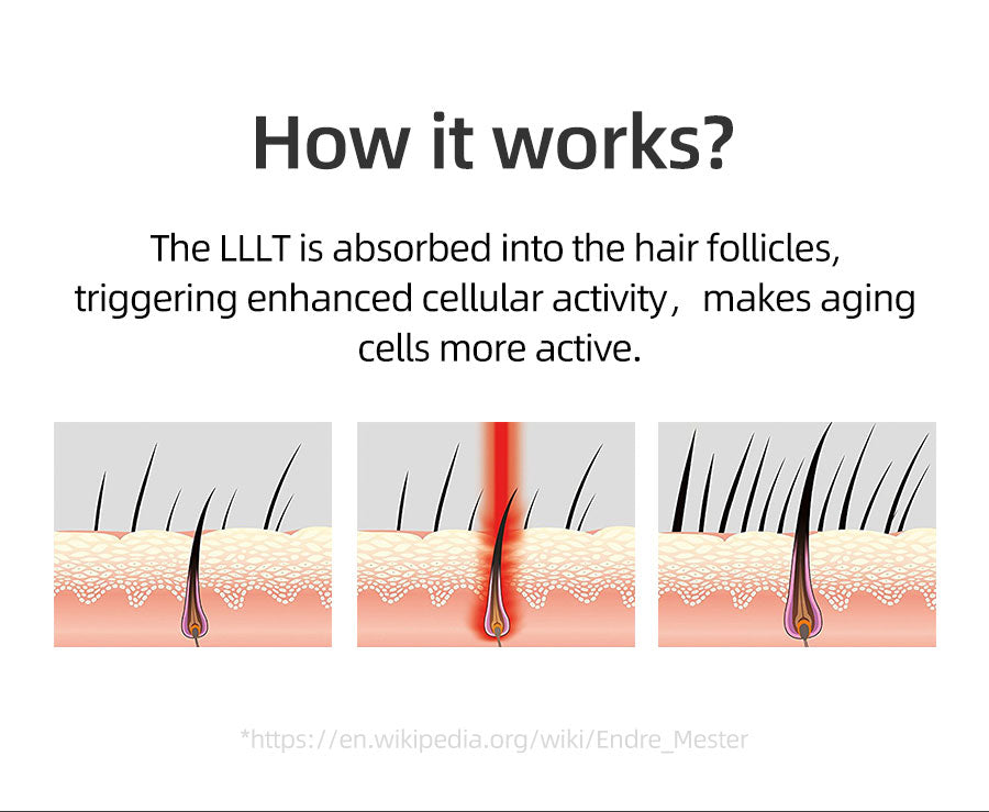 کلاهک رشد مو نوافولیکول LED - لیزر کم‌توان تایید شده توسط FDA