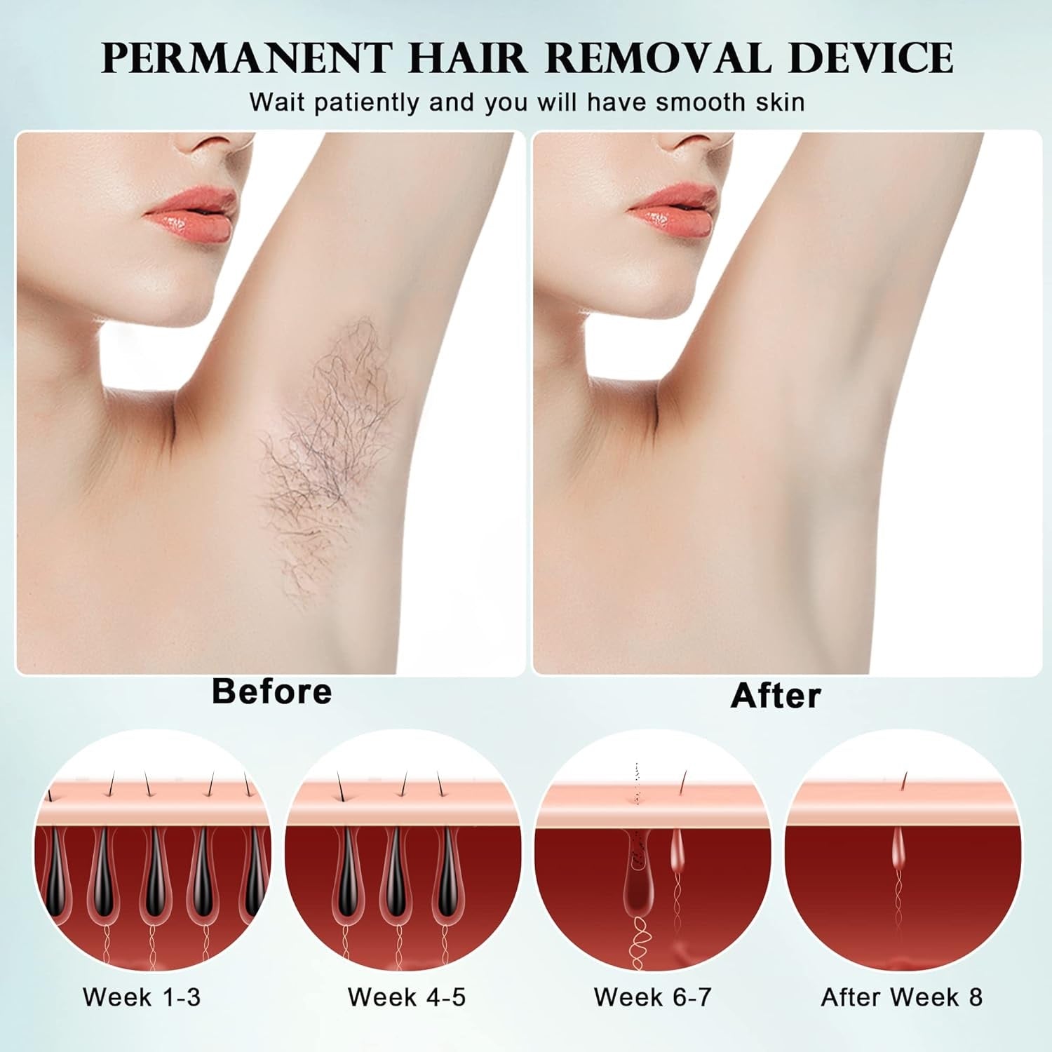 لوما ديرم 3 في 1 إزالة الشعر بتقنية IPL وتجديد البشرة في المنزل
