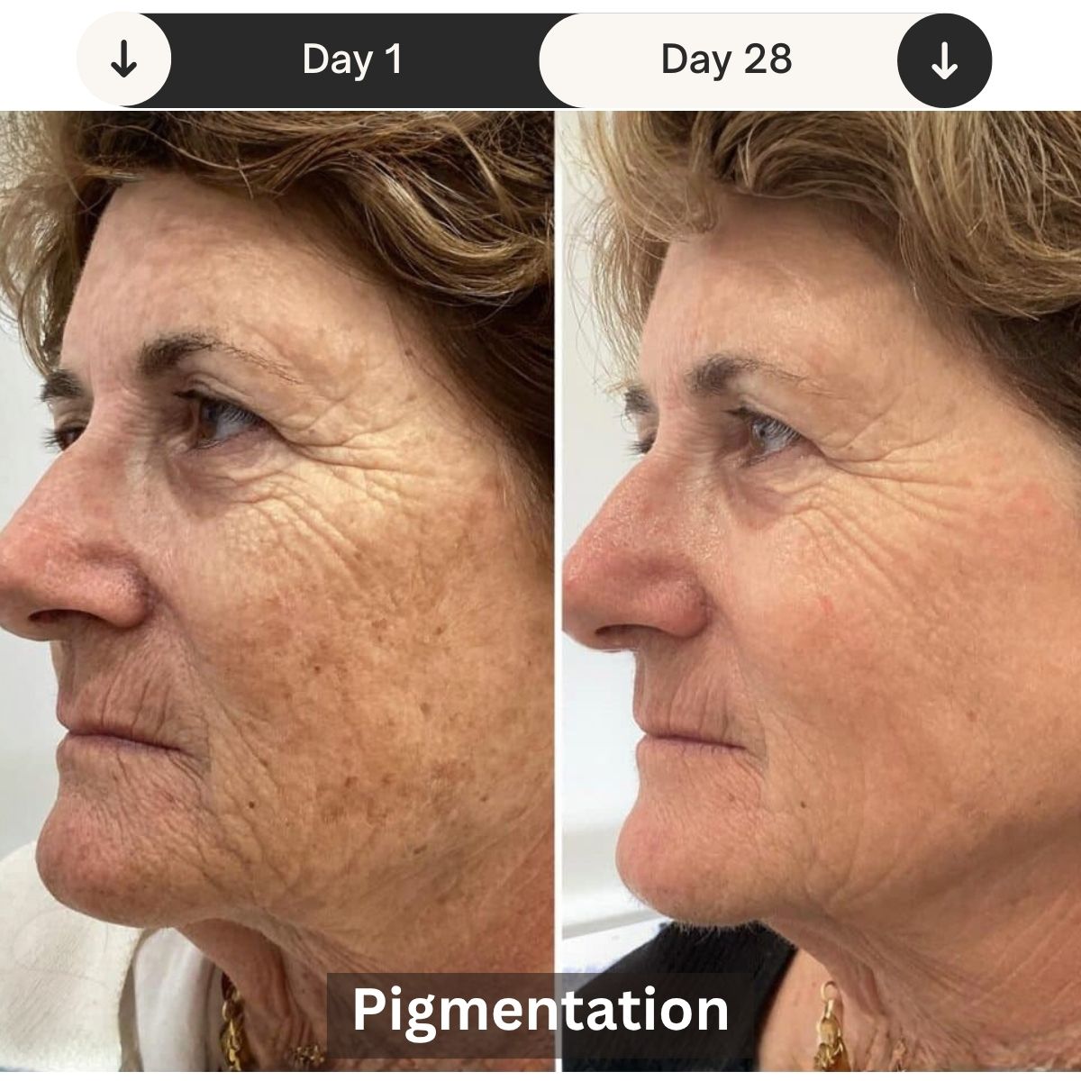 Professional LED Light Therapy Device For Skin Rejuvenation