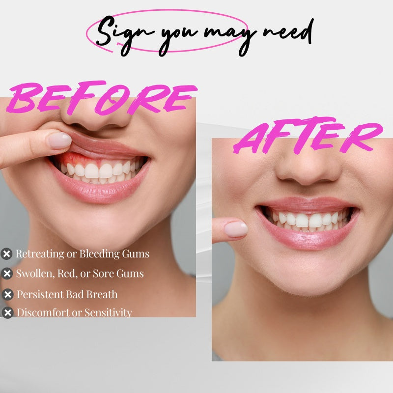 Red Light Therapy For Gums A Gentle Dental Care Device