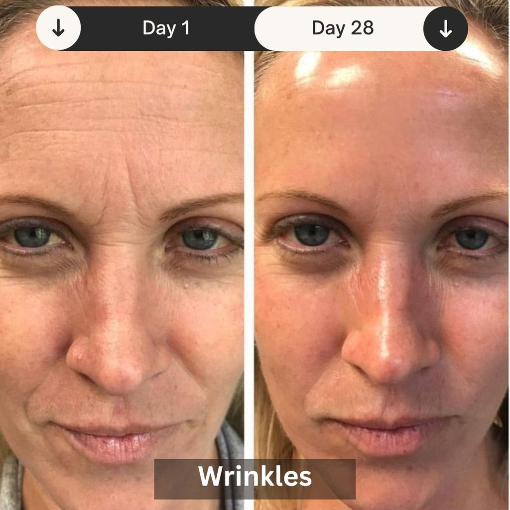 Professional LED Light Therapy Device For Skin Rejuvenation