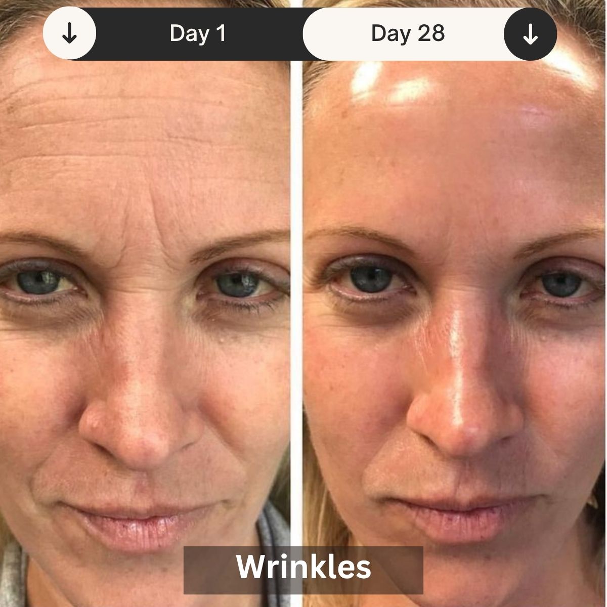 Professional LED Light Therapy Device For Skin Rejuvenation