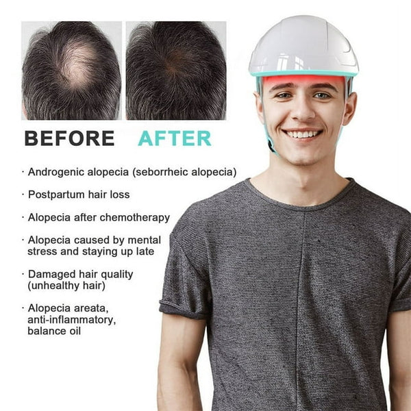 Trattamenti per la Ricrescita dei Capelli con Sistema a Cappello Laser