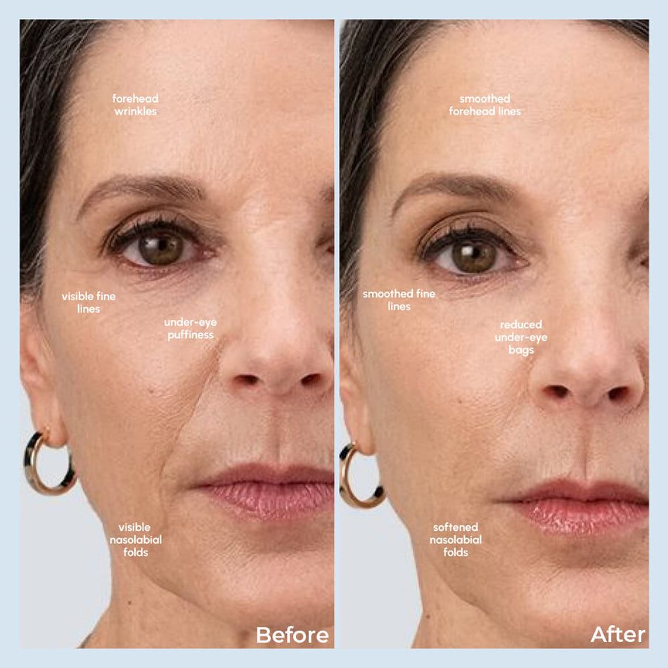 Veloria Multi-Beauty Wand Strumento per la Scultura del Viso per Risultati a Casa