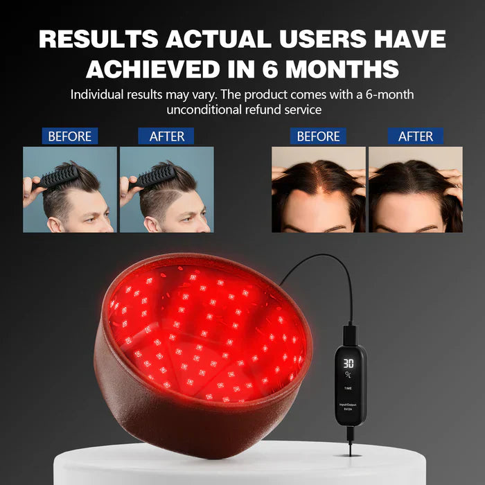 AstraGrowth Laser Hair Regrowth Cap 1.0 Pro Edition
