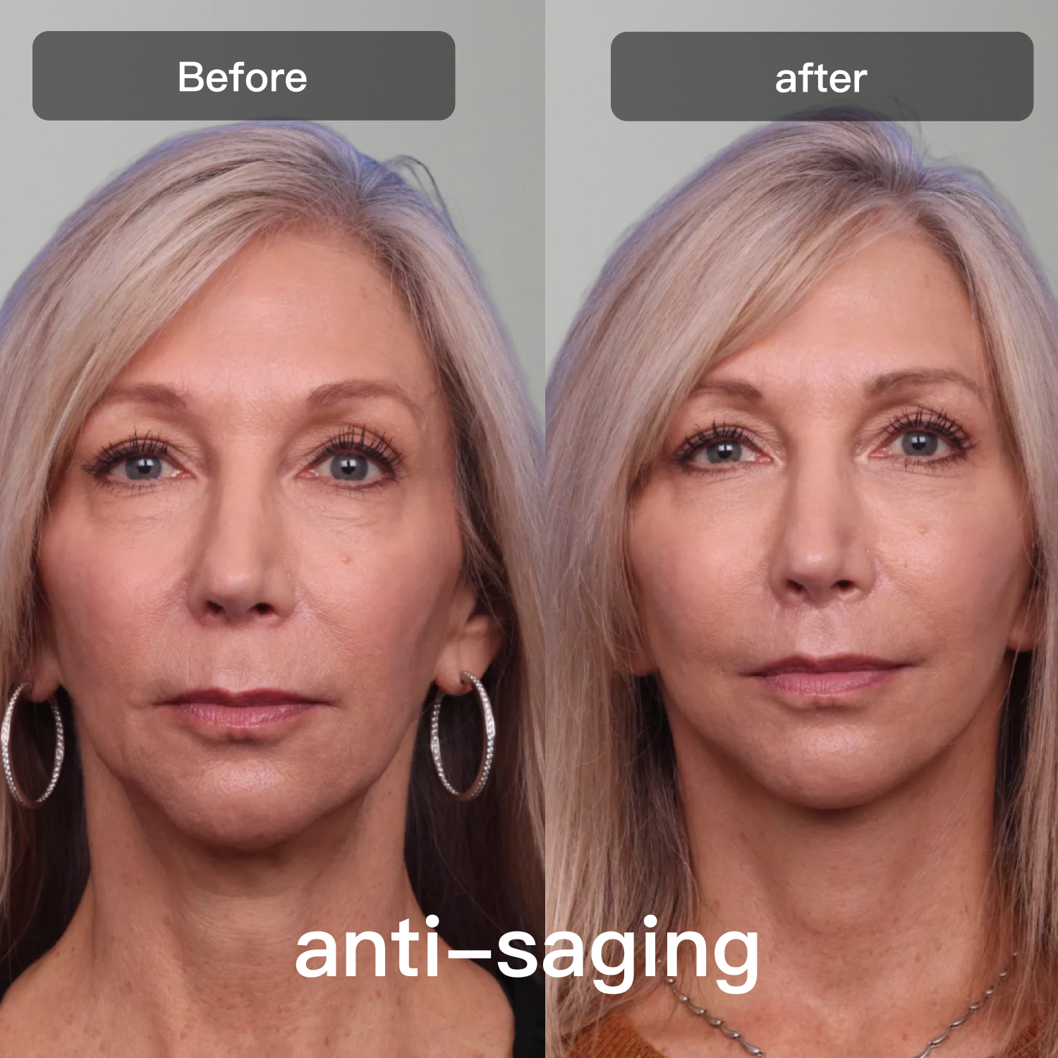 LED Light Therapy Device for Facial and Body Skin Care
