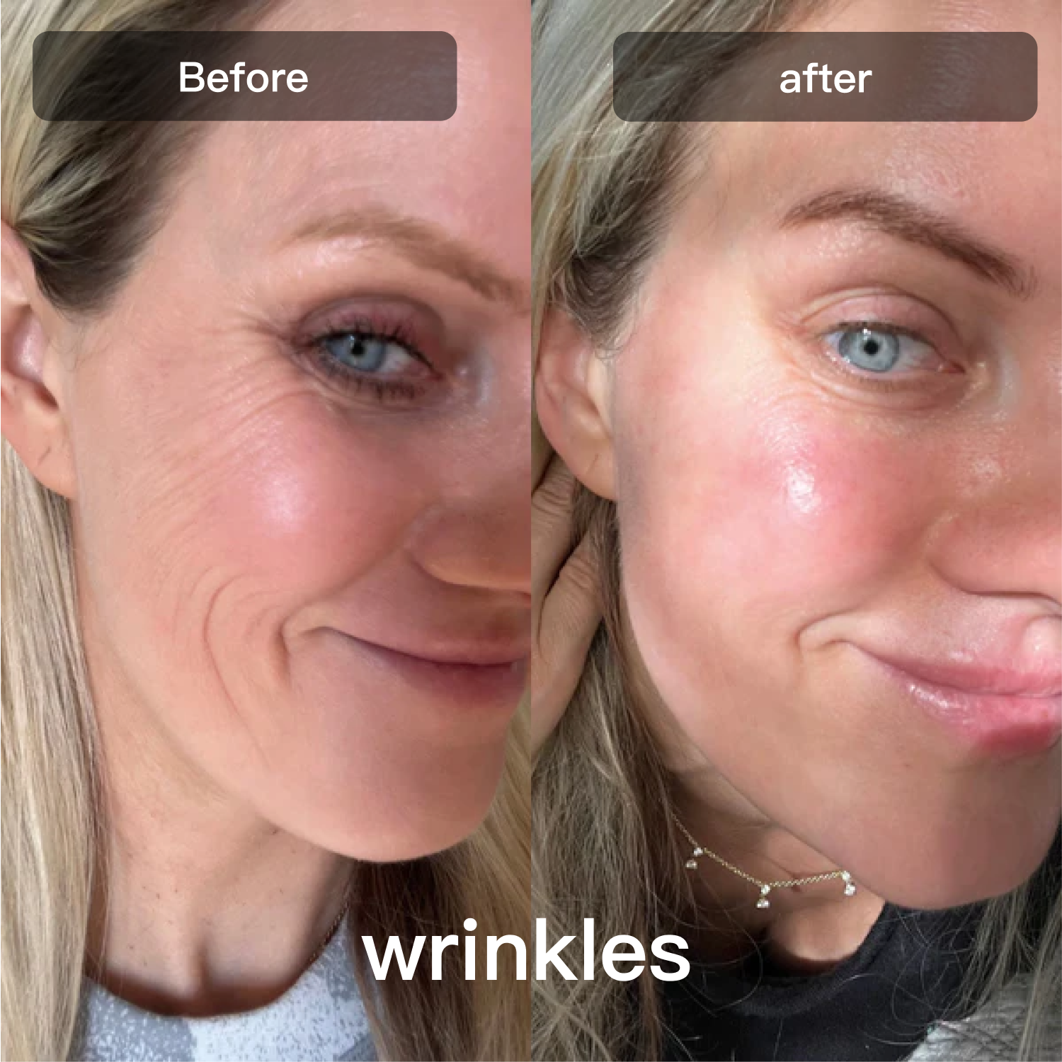 LED Light Therapy Device for Facial and Body Skin Care