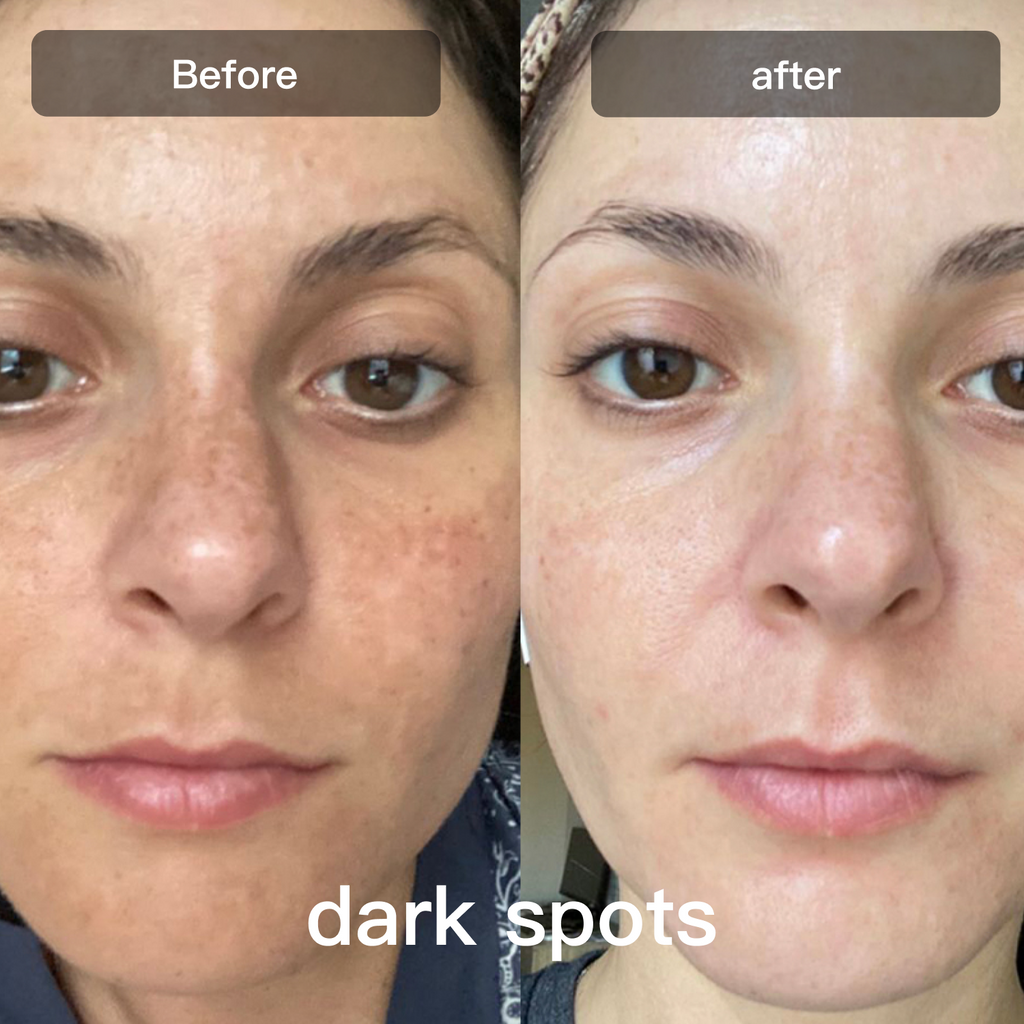LED Light Therapy Device for Facial and Body Skin Care