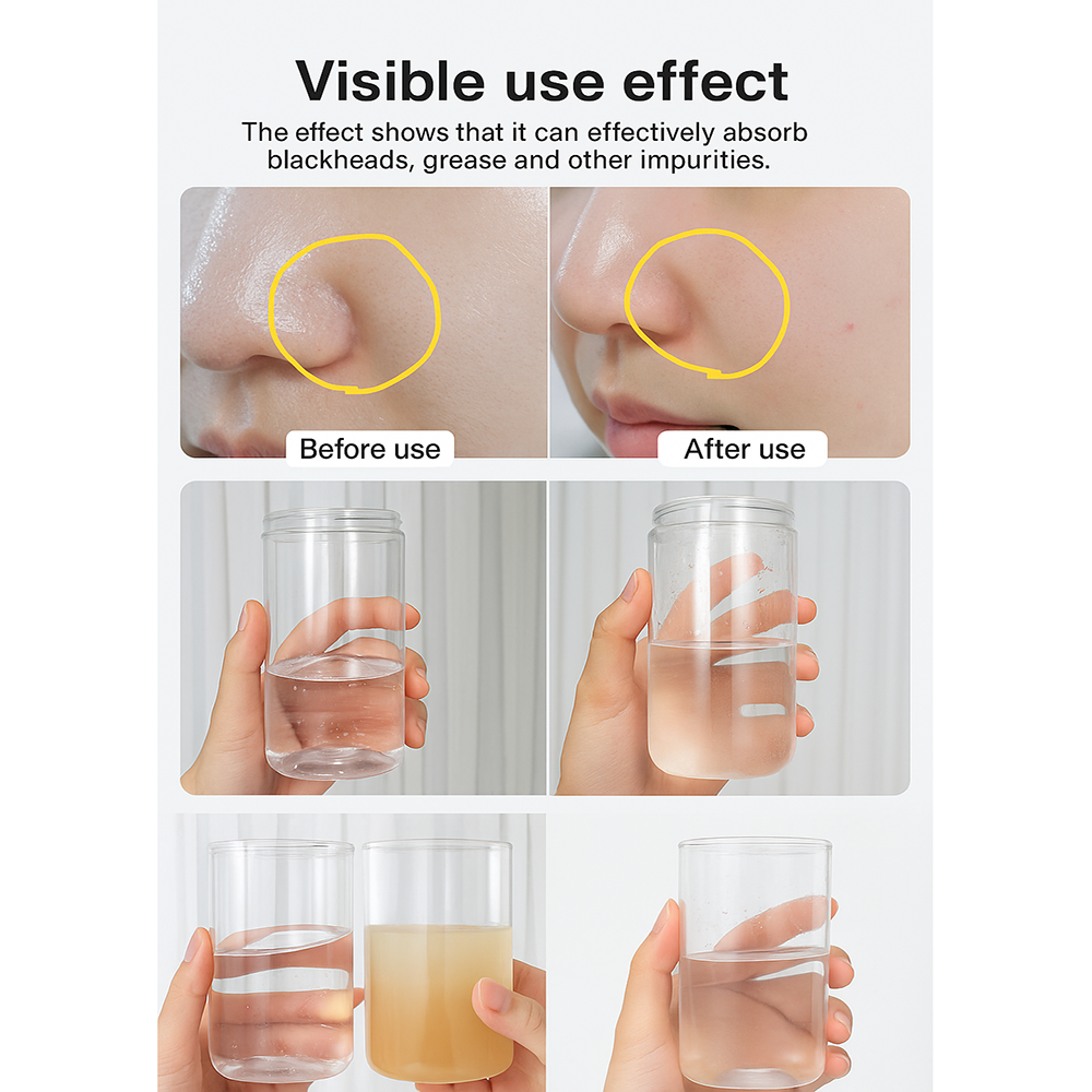 Wasserstoff-Sauerstoff-Blasen Aqua-Peeling Schönheitsgerät für Gesichtsbehandlungen und Spa